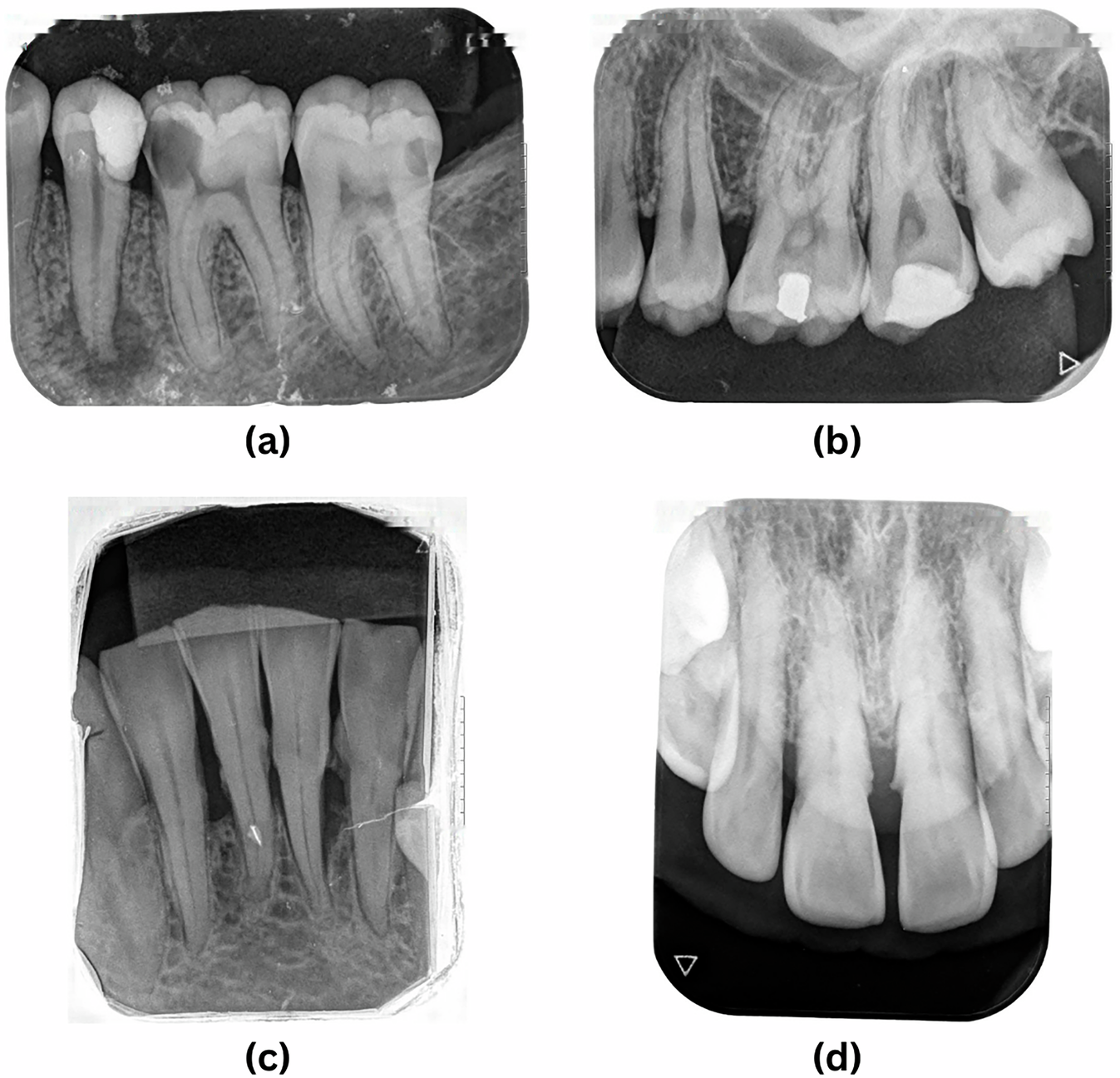Traditional 2D dental X-ray — flat single-angle film showing teeth and bone at Merry Dental Hub Wylie TX