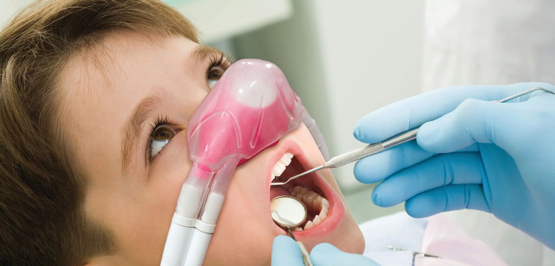 Soft nasal mask used for nitrous oxide (laughing gas) sedation at Merry Dental Hub in Wylie TX