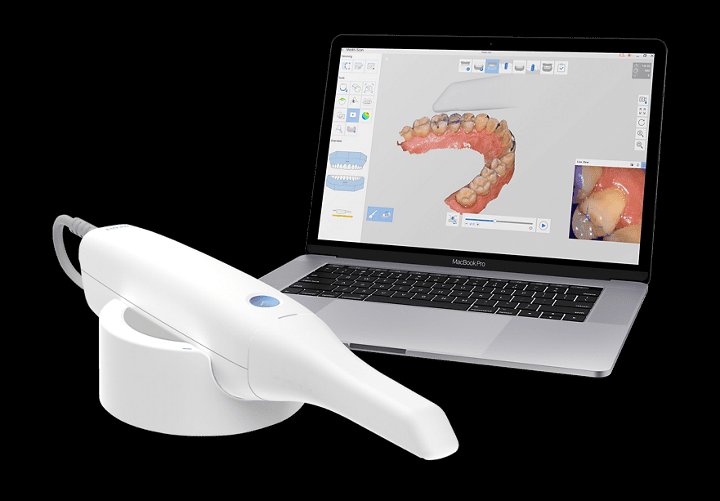 Medit intraoral digital scanner capturing a full-color 3D tooth model on a laptop — no-goop digital impressions for crowns, dental implants and clear aligners at Merry Dental Hub, Wylie TX 75098