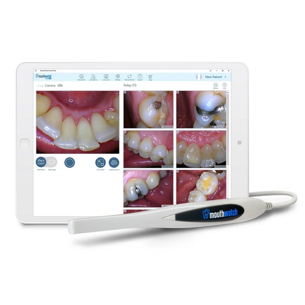 MouthWatch HD intraoral camera displaying high-definition tooth images on a tablet — patients see exactly what Dr. C sees in real time during exams at Merry Dental Hub, Wylie TX 75098