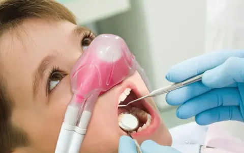 Nitrous oxide laughing gas sedation in Wylie TX